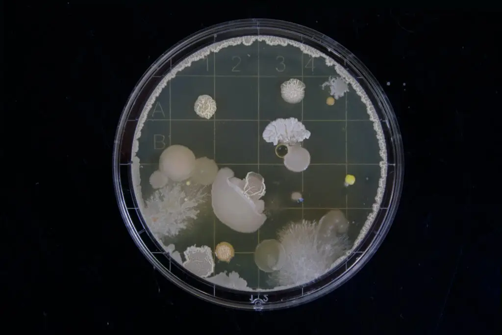 A petri dish containing various microbial colonies with distinct shapes and textures, illustrating cell membrane diversity in microbial growth.